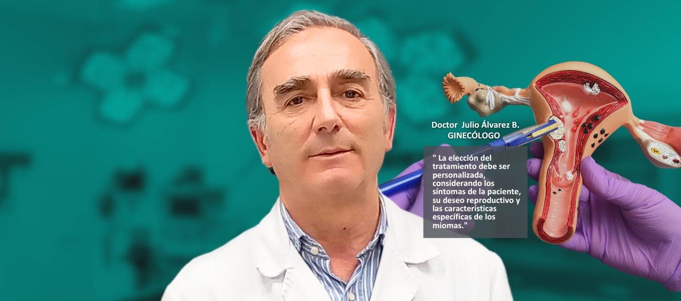 miomas uterinos diagnóstico y tratamiento