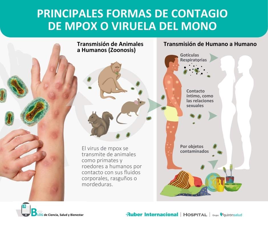 Cómo se transmite mpox viruela del mono