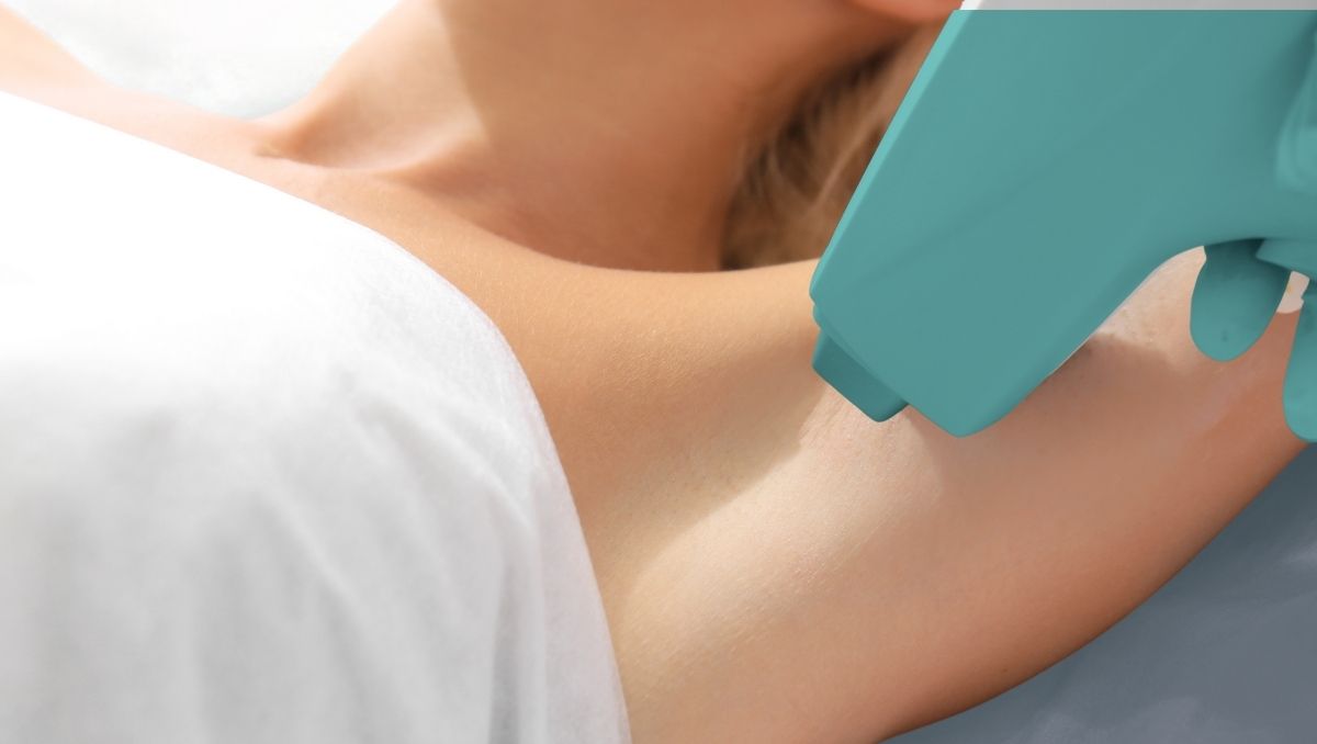 depilacion laser tratamiento hidradenitis supurativa