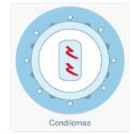 Condiloma