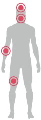 sintomas