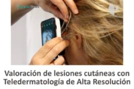 Teledematología