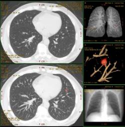 PulmonGeneral