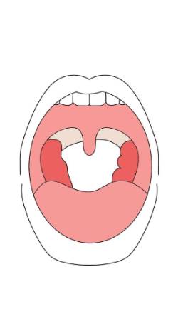 CAVIDAD ORAL Y FARINGE