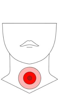LARINGE Y PATOLOGÍA CERVICAL