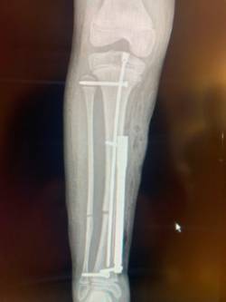 RX DISPOSITIVO_1