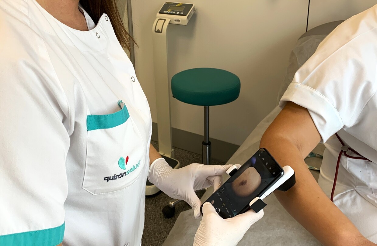 Foto dermatoscopio 1 (1)