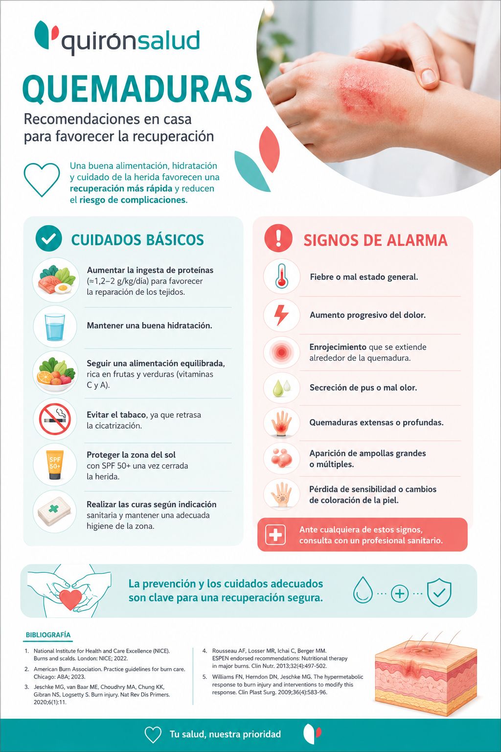 Cuidados en casa de quemaduras