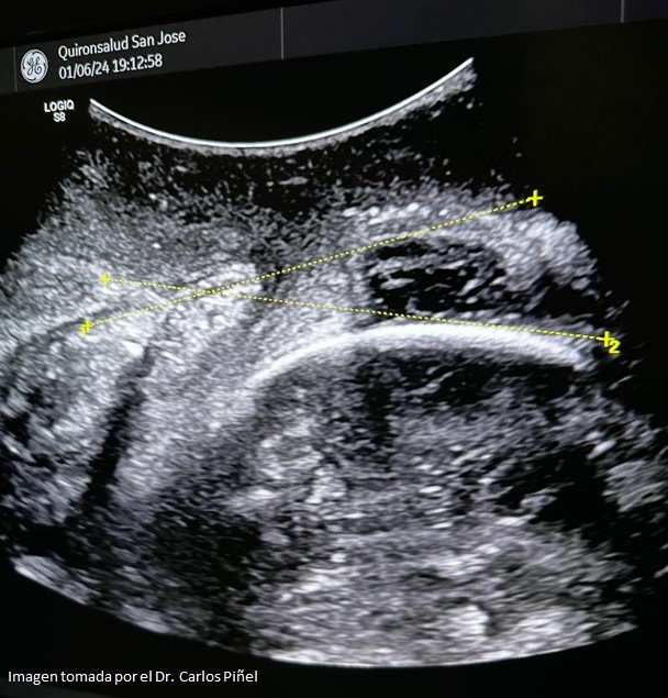Ecografía intraparto