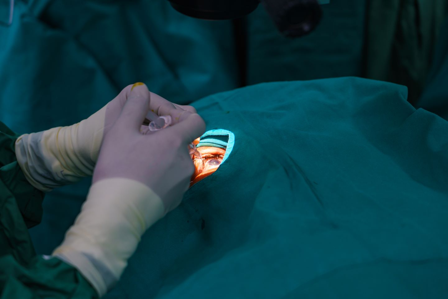 Lentes intraoculares