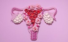 SOP-trastornos-endocrines