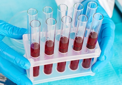 analisis clinicos quironsalud