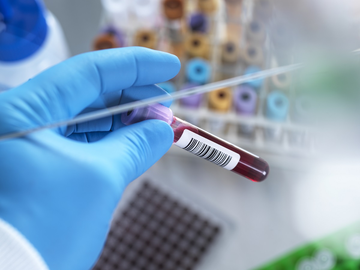 Hematologia Torrevieja