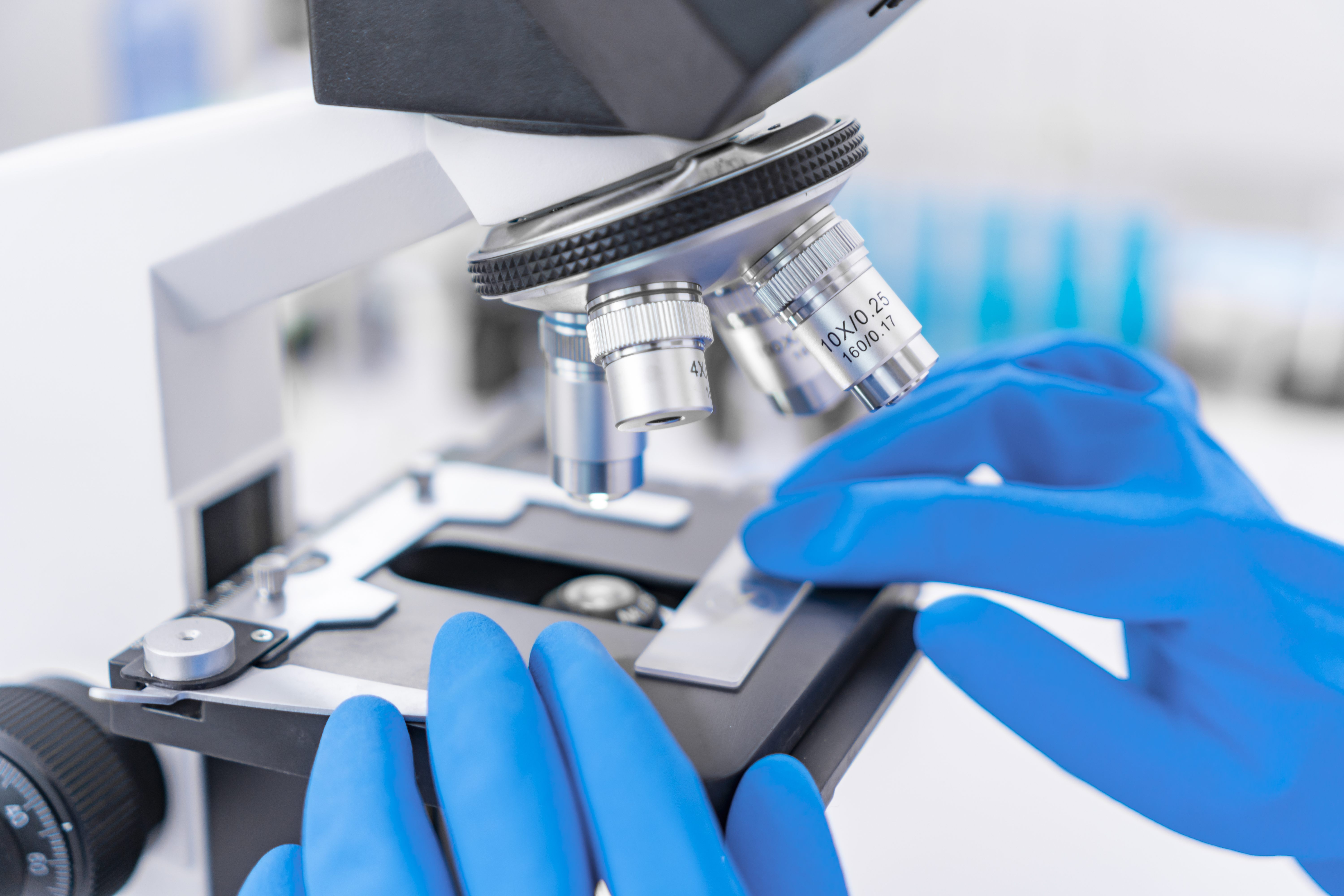 oncologia intervenconista rorrevieja quironsalud cancer