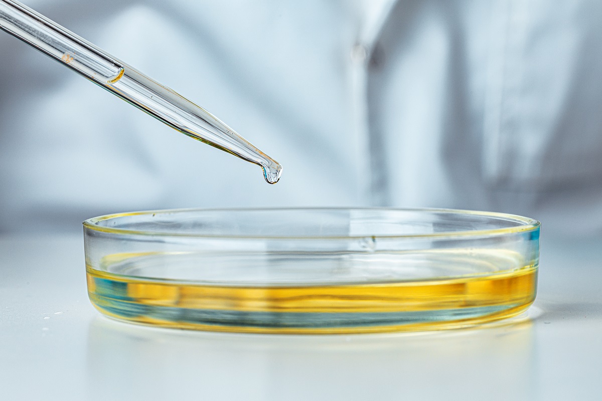 Como se realiza el estudio urodinamico TORREVIEJA quironsalud