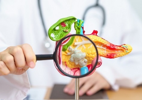aparato digestivo pancreas cirugia robotica da vinci