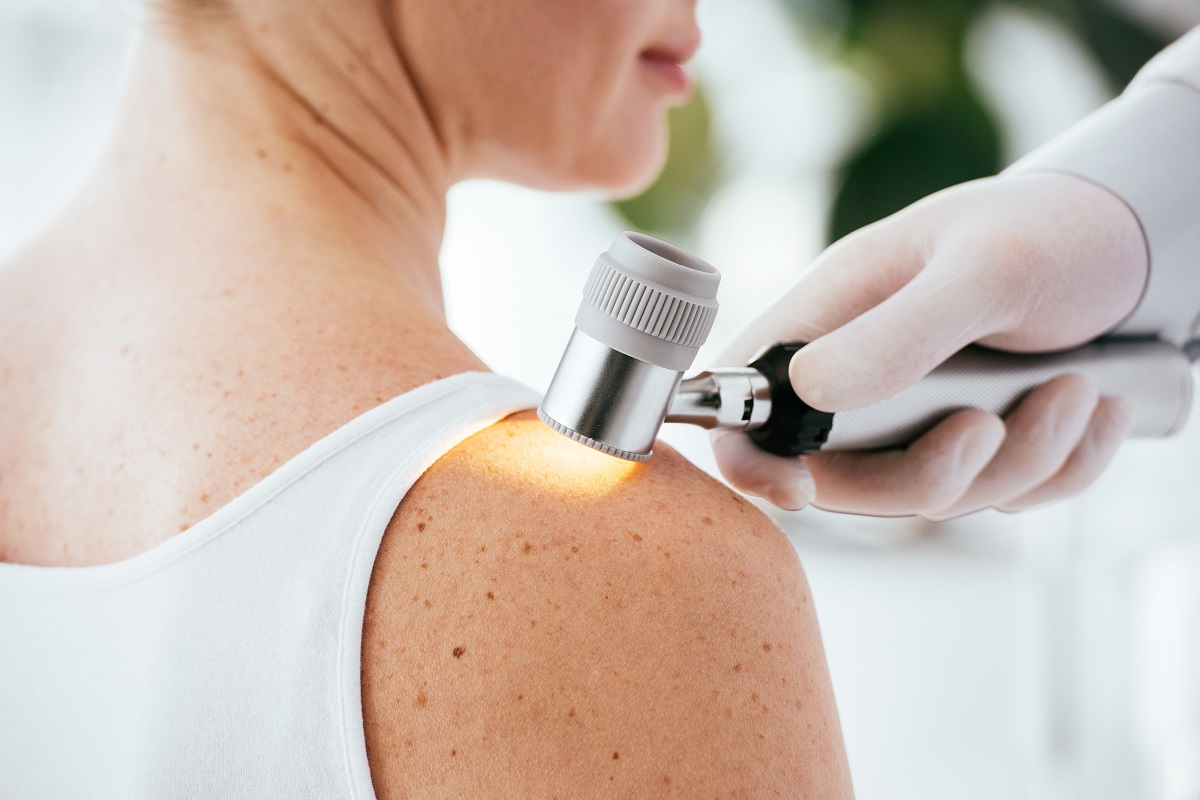 dermatologia clinica torrevieja