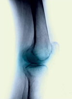 CirugiaOrtopedica-Trauma