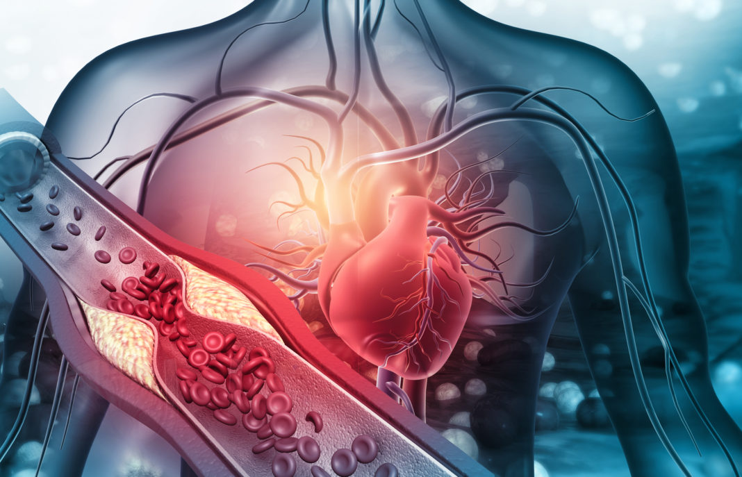 cardiologia intervencionista hemodinamica valencia quironsalud