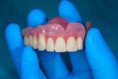 Prótesis dentales Quirónsalud Valencia