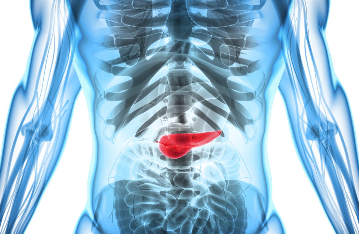como cirugia cancer pancreas quironsalud Valencia