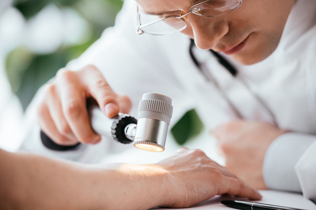 especialistas melanoma valencia