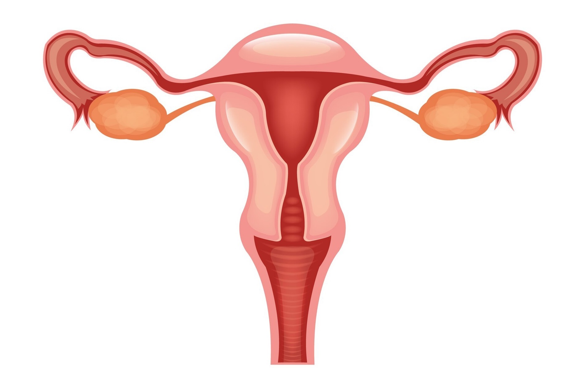 Miomectomía miomatosis uterina miomas quironsalud Valencia