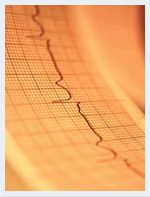 electrocardiograma