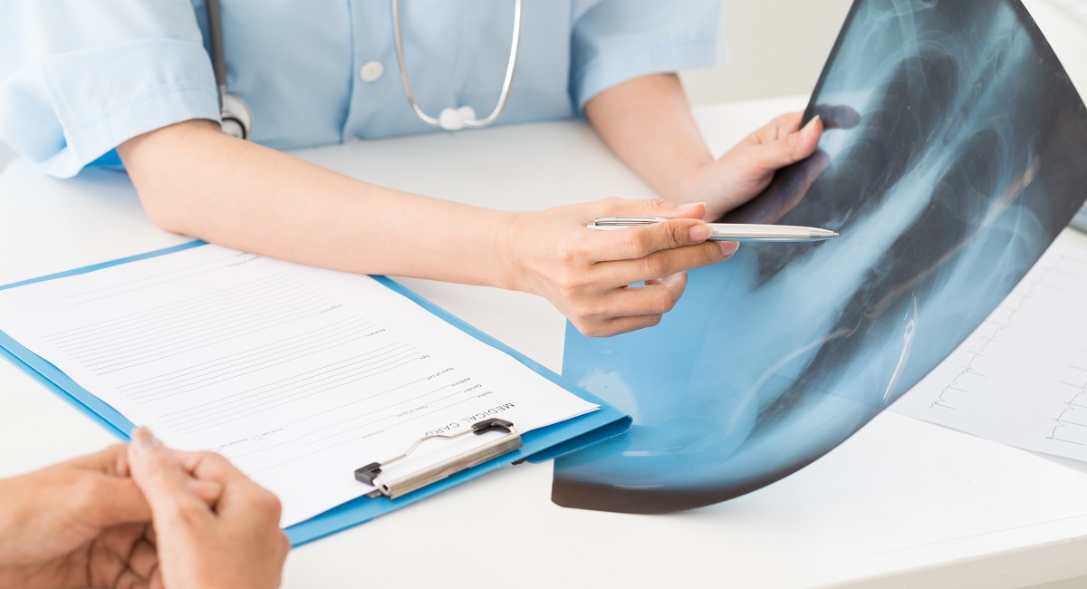 cancer de pulmon valencia quironsalud
