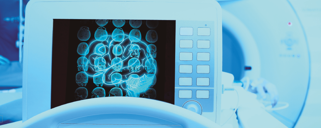 neurofisiologia valencia