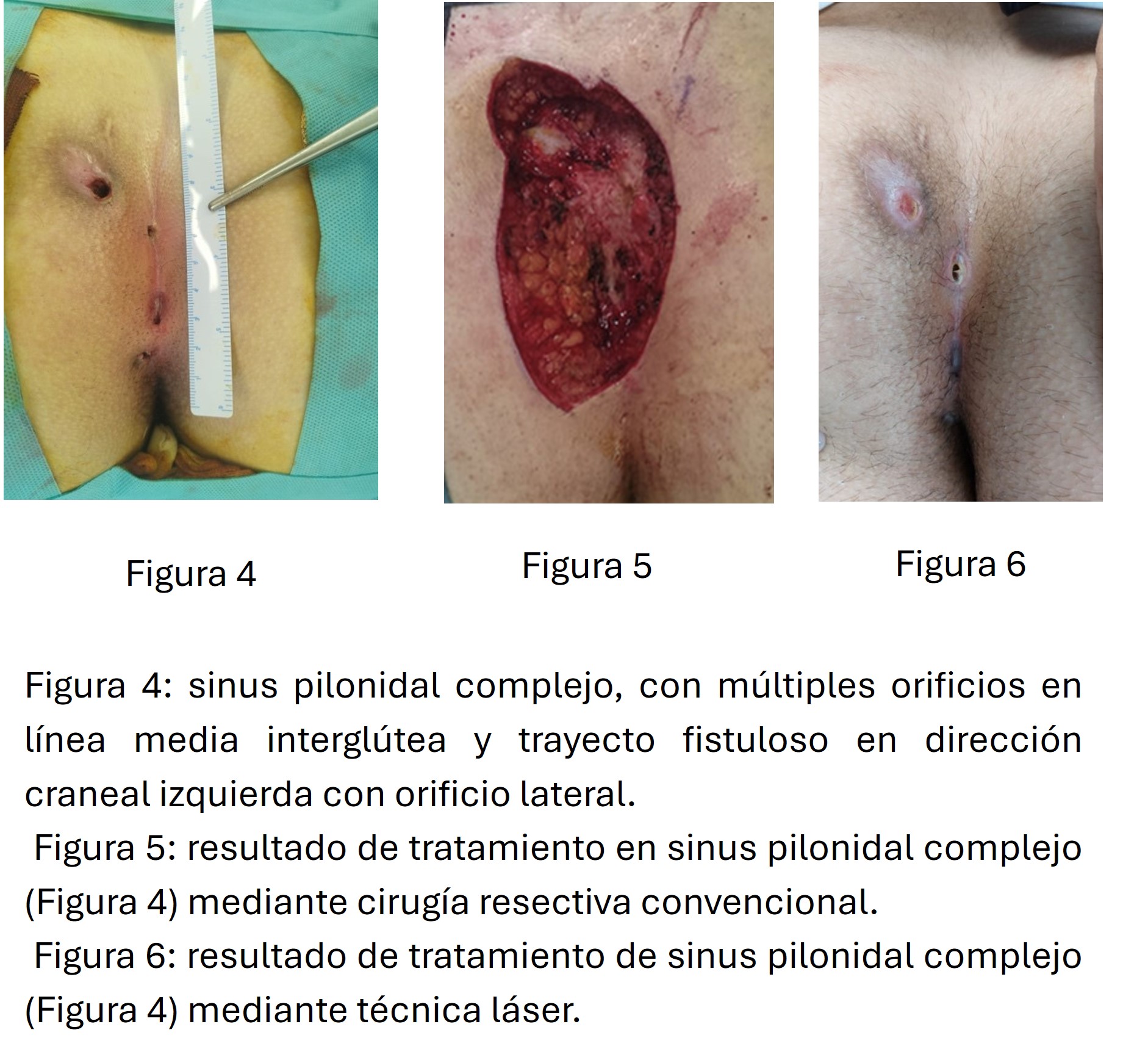 Imagen6