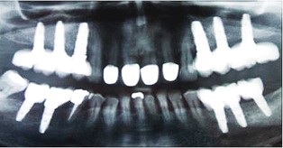 Cirugía Oral y Maxilofacial