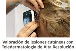 teledermatologia. Este enlace se abrirá en una ventana nueva