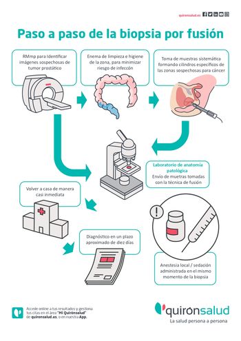 Biopsia por fusion-tenerife precio quironsalud