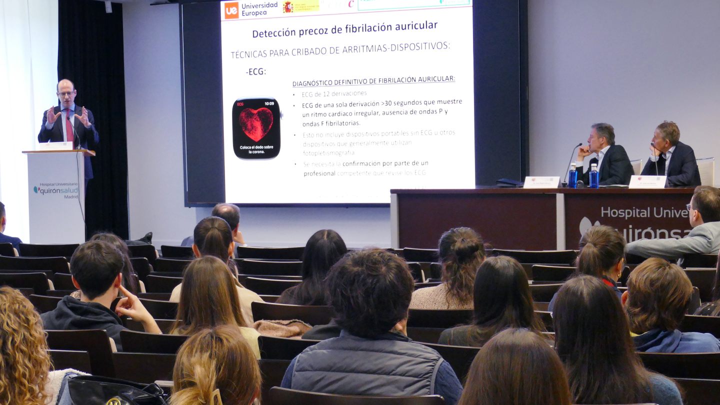 curso fibrilacion auricular