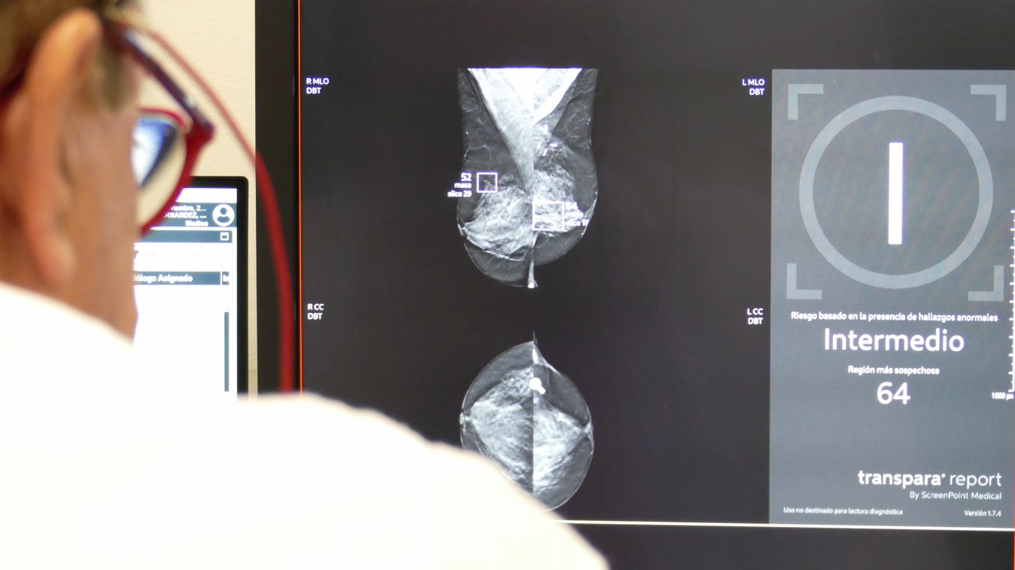 IA en Diagnóstico por la Imagen3_mamografia
