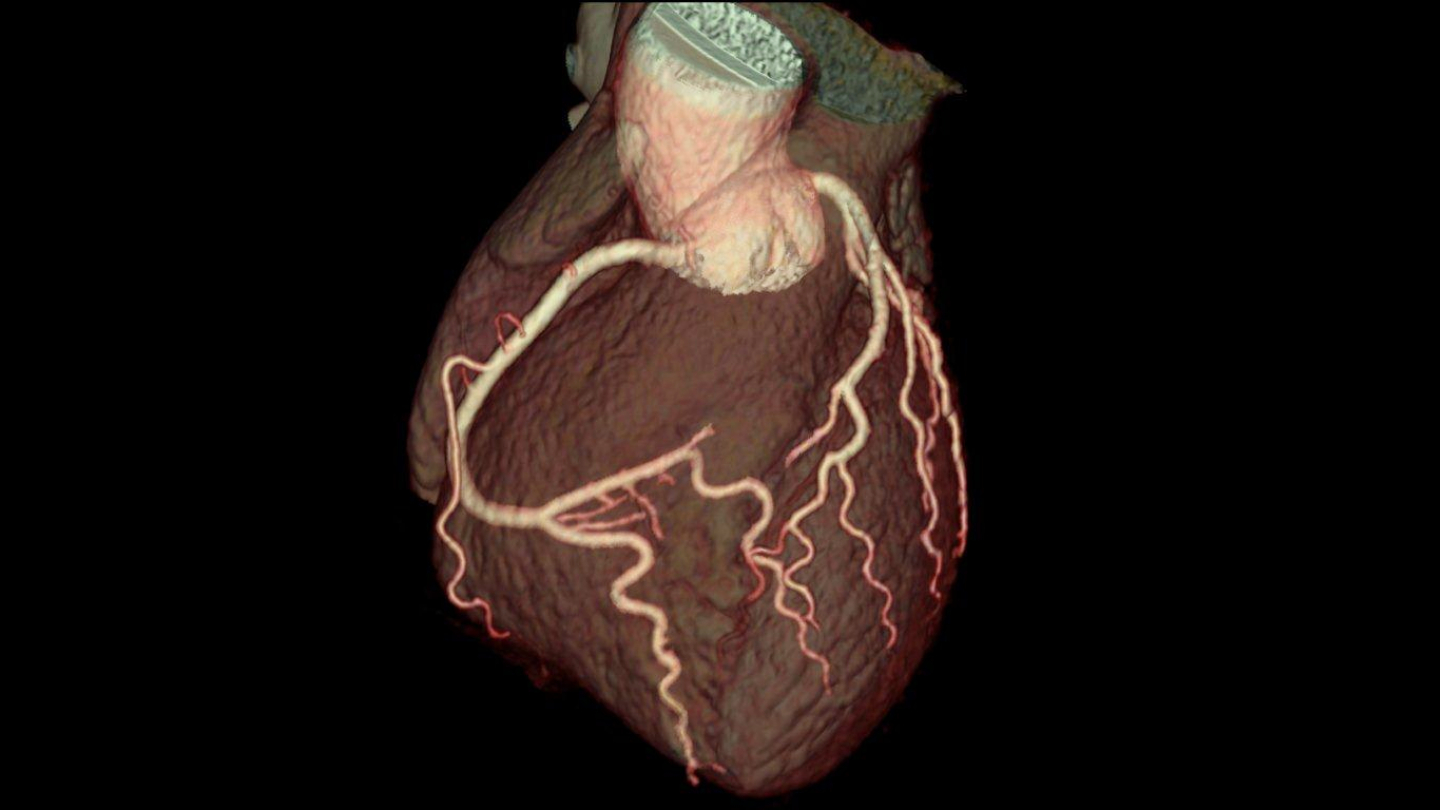 3D Heart