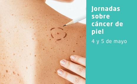 Jornada Cancer de Piel
